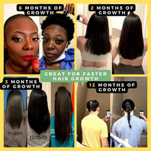 Load image into Gallery viewer, (10 in 1) Hair Growth Oil