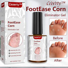 Load image into Gallery viewer, Feet Corn Removal Serum 30ml(Pack Of 1)