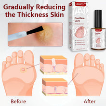 Load image into Gallery viewer, Feet Corn Removal Serum 30ml(Pack Of 1)