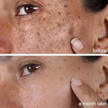 Load image into Gallery viewer, TURMERIC DARK SPOT CORRECTOR SERUM FOR MEN AND WOMAN