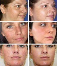 Load image into Gallery viewer, TURMERIC DARK SPOT CORRECTOR SERUM FOR MEN AND WOMAN