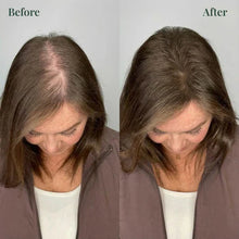 Load image into Gallery viewer, 🔥 BUY 1 GET 1 FREE! 🌿 Kerarose Rosemary Shampoo for Hair Growth 💪✨