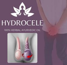 Load image into Gallery viewer, Hydrocele Ayurvedic Oil 🔥 BUY 1 GET 1 FREE 🔥