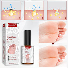 Load image into Gallery viewer, Feet Corn Removal Serum 30ml(Pack Of 1)
