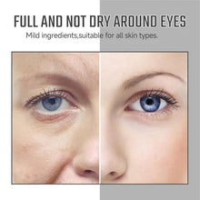 Load image into Gallery viewer, 🔥 BUY 1 GET 1 FREE 🔥Lutein Anti Wrinkle Firming Serum ✅
